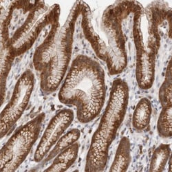 RNF213 Antibody, Novus Biologicals 25 &mu;L; Unlabeled:Antibodies, Polyclonal